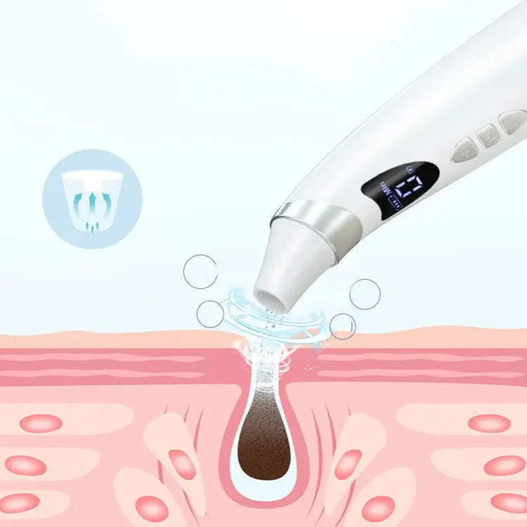 Smart Visual Blackhead Remover Cashymart